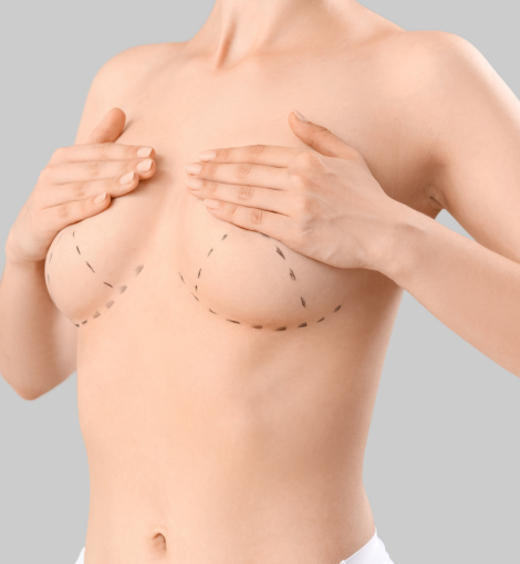 breast lift