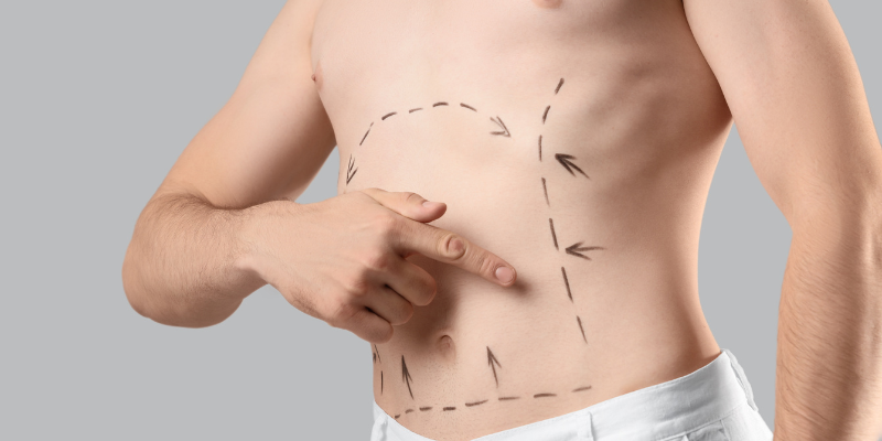 male plastic surgery male plastic surgery